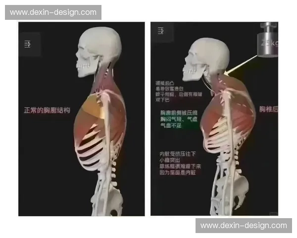 运动矫正球助力体态改善与运动康复效果的提升与应用分析 运动矫正球助力体态改善与运动康复效果的提升与应用分析